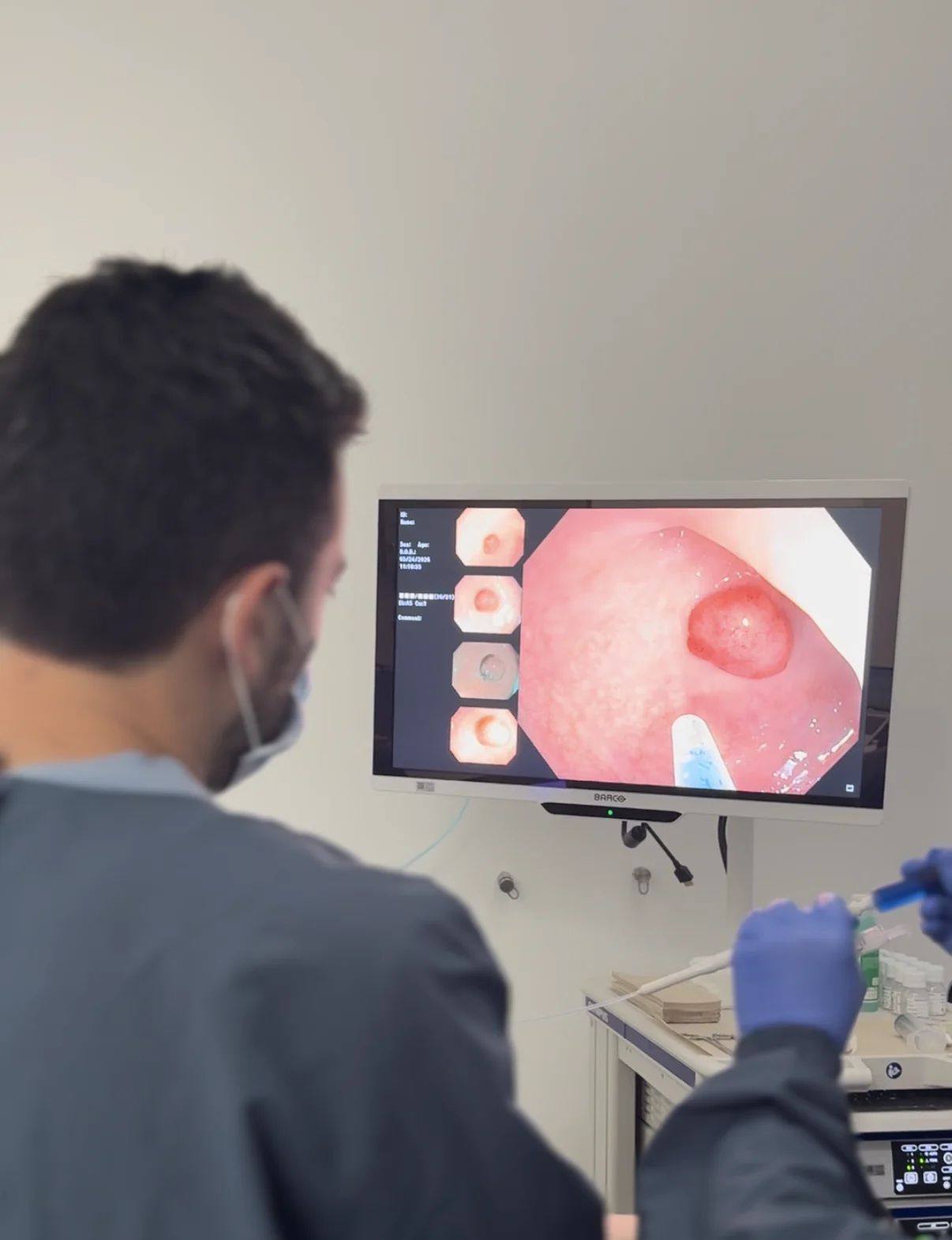 El Dr. Peinado revisa en el monitor una lesión durante un examen endoscópico